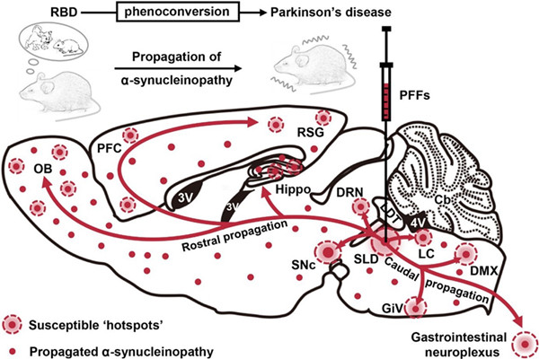 -突触核蛋白病理性RBD小鼠模型的制备及向帕金森表型转归示意图_副本.jpg