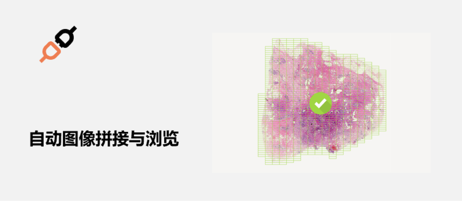 人工智能在脑肿瘤诊疗中的应用