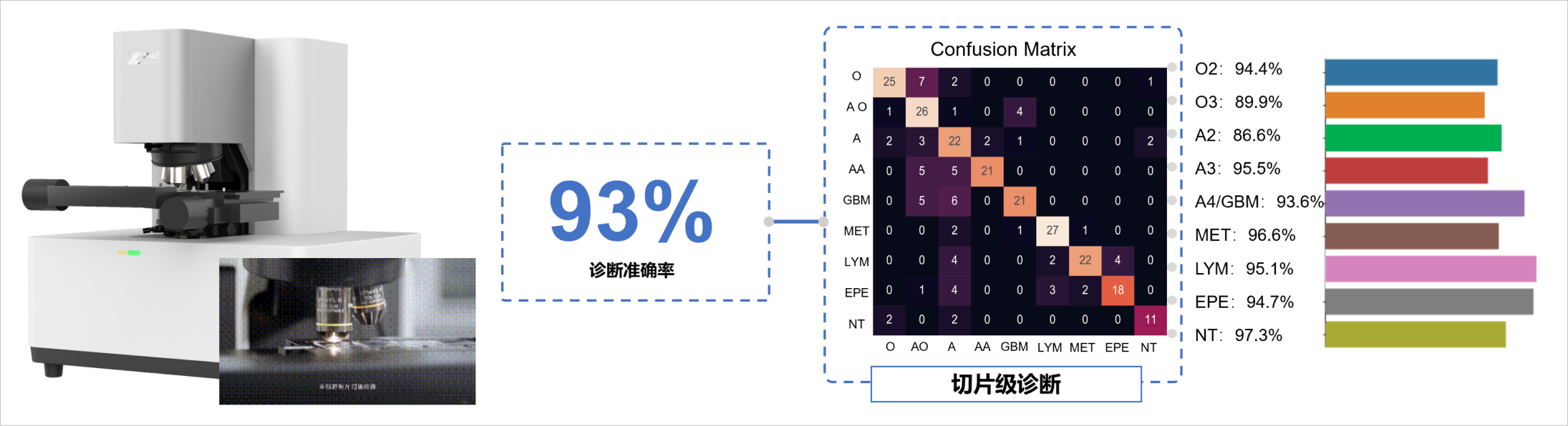 人工智能在脑肿瘤诊疗中的应用